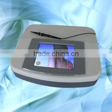 RBS/spider veins removal machine/treat blood vessels/Facial vascular treating