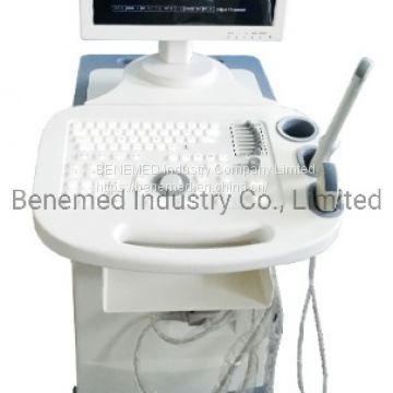 High Quality Trolly Build-in Black and White Ultrasound Scanner