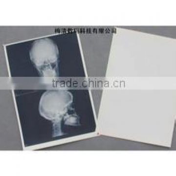 hot selling good quality Konida use fuji dry film medical x-ray film