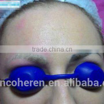 Most Effective Tattoo Removal Laser Equipment Removal Tattoo Laser photo-6