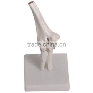 MCT-KN-013 Elbow Joint Model