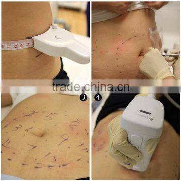 2016 New OEM Body Slimming Liposunic photo-6