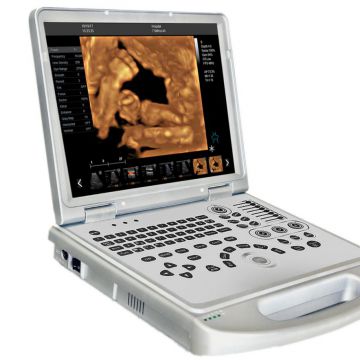 4D Baby Portable Medical Color Doppler Ultrasound Machine