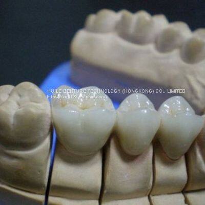 Dental Laboratory Full Ceramic Zirconia Crown Manufacturer in China