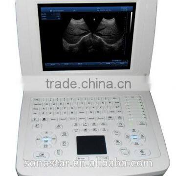 V10(SS-10V) Veterinary Laptop PC Based Ultrasound B Scanner(3D image optional)