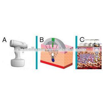 8MHz 2016 Body Shape Fastest Weight Loss Chest Shaping Slimming Liposonix HIFU Portable Ultrashape Cavitation Machine High Frequency Beauty Machine photo-2