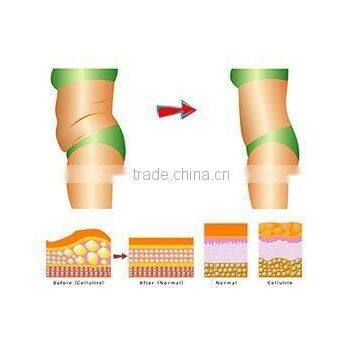 Best Quality Cellulite Removal Kuma Shape Body Slimming Machine for Sale photo-6