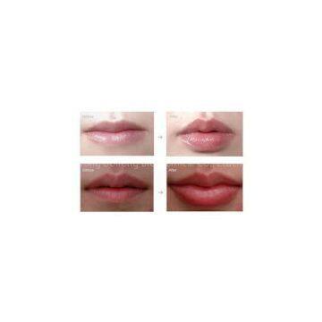 Pure hyaluronic acid filler Used for Lips enhancement