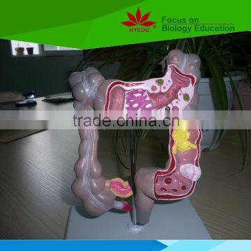 Direct factory supplied Colon and emptyileum intestine model