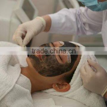 Distributors Wanted Best Selling Products Laser Tattoo Removal / Pigmentation Removal q Switch nd Yag Laser Machine for Sale