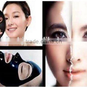 Professional clinic use carbon skin revitalizer yag laser 1064nm and 532nm laser machine