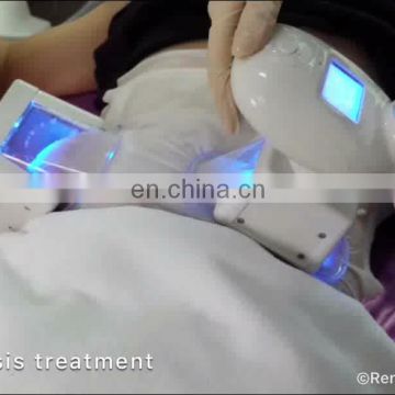 Cavitation RF weight loss Cryolipolysis slimiming machine