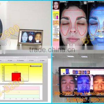 Fat Analysis Machine Bioelectrical Impedance Human Body Analyzer photo-6