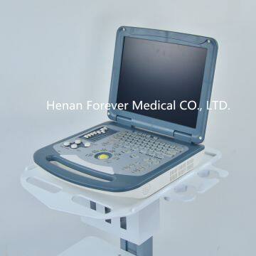 3D / 4D Digital Ultrasound Machine /scanner Color Doppler photo-3