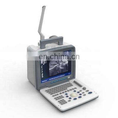 Medical Ultrasound Instruments 12 inch Portable Full Digital 2D/3D/4D Ultrasound Machine for Hospital use