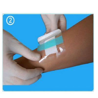 Vendas médicas transparentes, productos de la serie de vendas autoadhesivas para heridas
