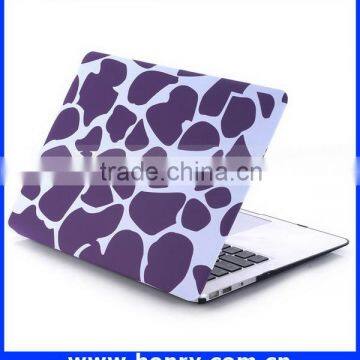 Top Level Cheapest Hard Cover Case for Macbook Air 11 photo-3
