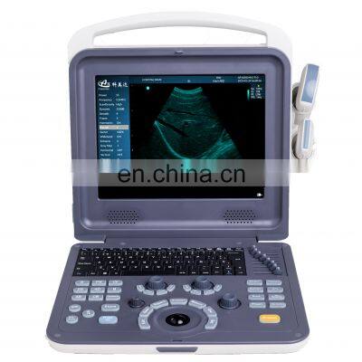 Ce certification Portable 15 inch physiotherapy ultrasound  color doppler ultrasound for hospital use