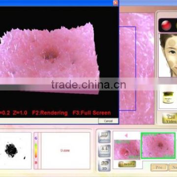 Portable Faical Skin Analysis Machine 3D TM-HT907