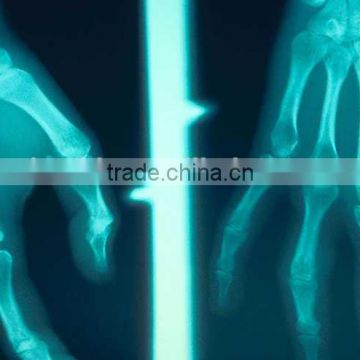 medical thermal x ray film,x ray film china,conventional roentgenogram