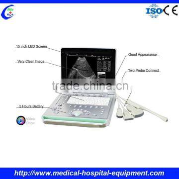 Laptop Ultrasound Machine