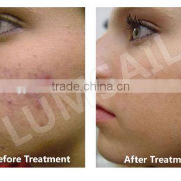 Acne Removal PDT LED Beauty Machine LED Phototherapy Beauty System Skin Rejuvenation photo-4