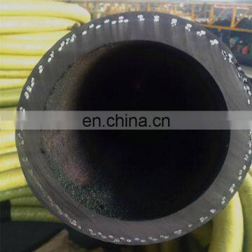 Factory Supply High Quality Concrete Pumping Hose Clamps and Gaskets