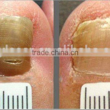 Ipl Laser Hair Removal Beauty Parlor Machine for Sale photo-3
