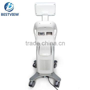 Skin Tightening 2016 Most Advanced High Intensity Focused Ultrasound Back Tightening HIFU Body Slimming Lipo Hifu Machine/ HIFU Slimming Machine Portable photo-4