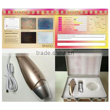 dermatoscope skin analyzer AYJ-J016