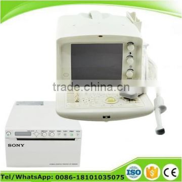 Carejoy Cheapest Portable Ultrasound machine with multi frequency probe SONY UP-898MD video thermal recorder optional