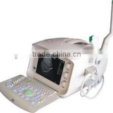 Medical Portable Ultrasound Scanner AJ-6100B