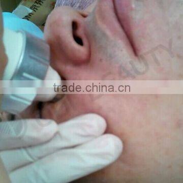 Skin Tightening Beauty Machine OD-R105 Face Lifting Portable rf Radio Frequency Facial Machine for Home Use photo-2