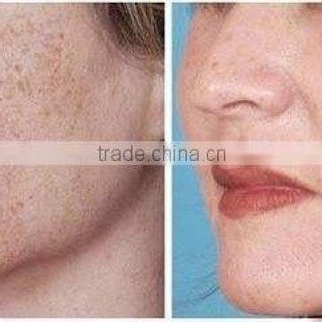 Hair Removal Skin Care e Light +rf +yag Laser Beauty Salon Equipment