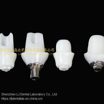 Dental Implant Abutment, Implant Crown, Implant Prosthesis, Laboratoire Dentaire, Dentallabor, Laboratorio Dental, Dental Laboratory, Shenzhen LJ Dental Lab China photo-3