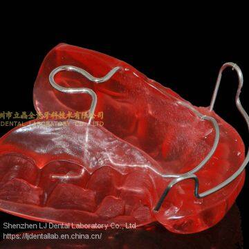 Dental Orthodontic Appliance, Bionator Appliance, Frankel Appliances, Fan-type Expander, Laboratoire Dentaire, Dentallabor, Laboratorio Dental, Dental Laboratory, Shenzhen LJ Dental Lab China photo-5