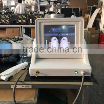Skin Tightening HIFU