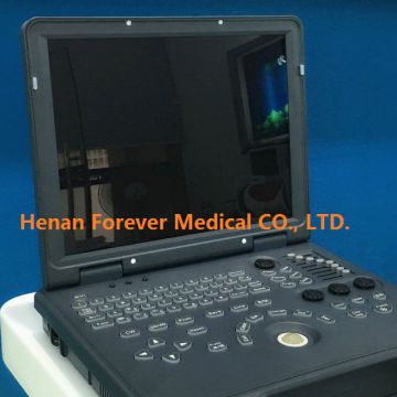 4D Color laptop Doppler Ultrasound