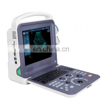 Portable Color Doppler Medical Ultrasound Instruments