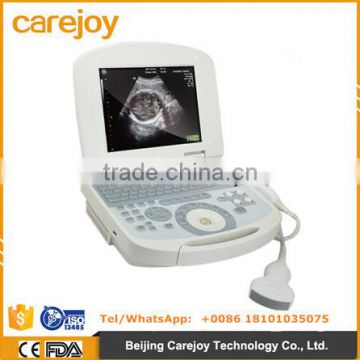 Cheap price portable ultrasound scanner with 3.5Mhz convex probe manufacturer