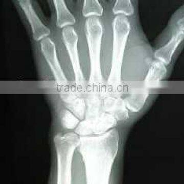 konica printing machine, dry imaging film, konida medical x ray film