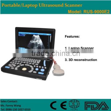 CE approved Laptop Portable Ultrasound Scanner with 3.5Mhz multi-frequency convex probe RUS-9000E2