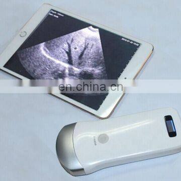 Working on Iphone Ipad Android phone/pad Medical Ultrasonic Scan Equipment Portable Wireless Ultrasound Probe