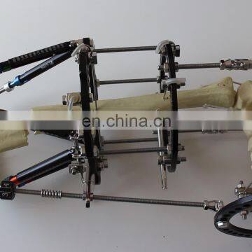 External fixator, hoffman external fixation, orthopedic external fixation