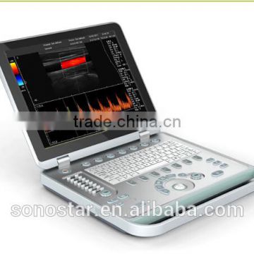 C5 laptop color doppler ultrasound scanner(low price)