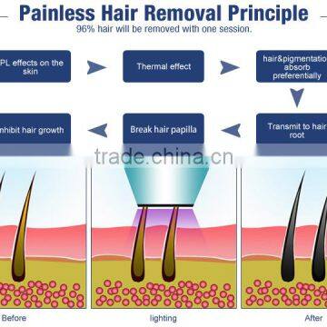 High Quality Most Popular Products for Salon SHR+E-light(IPL+RF )Machine With 2 Handles photo-5