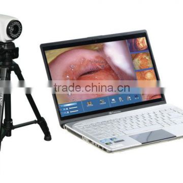 professional Digital Electronic Colposcope with high quality