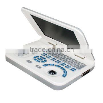 Carejoy Ultrasound Machine Portable Ultrasound Scanner With Multi Frequency Probe for Hospital Clinics Community RUS-9000F2 photo-3