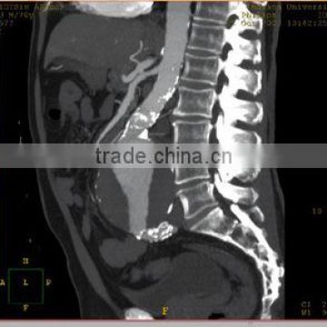 Agfa dry medical film, digital x-ray cr, thermal film used in hospital