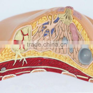 Medical breast disease model breast anatomical model medical training model breast feeding model